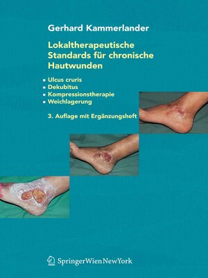 cover image of Lokaltherapeutische Standards für chronische Hautwunden